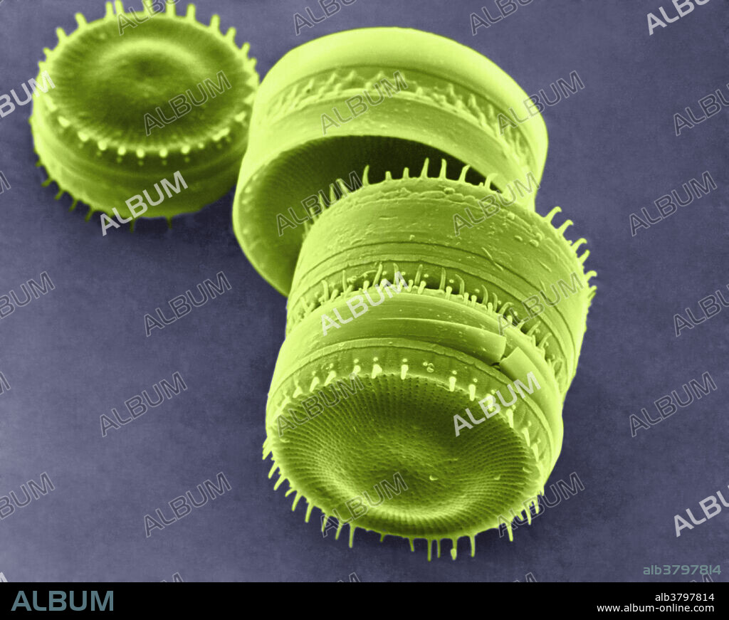 Diatom - Stephanodiscus astraea (SEM)