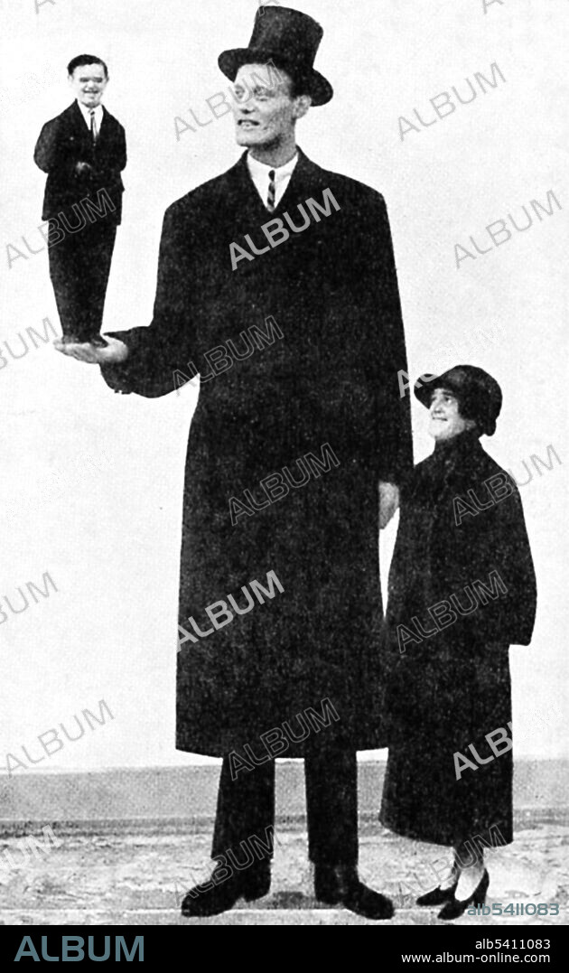 A photograph of Albert Johan Kramer, a giant, holding Fred Aslett, a dwarf. Kramer is 8 ft 9 3/4 inches; Aslett is 2ft 4 inches. The woman is of normal height. Gigantism is a rare disorder resulting from increased levels of growth hormone before the fusion of the growth plate, which usually occurs at some point soon after puberty. This increase is most often due to abnormal tumor growths on the pituitary gland. Dwarfism can result from many medical conditions, each with its own separate symptoms and causes. Extreme shortness in humans with proportional body parts usually has a hormonal cause, such as growth-hormone deficiency, once called pituitary dwarfism. Two disorders, achondroplasia and growth hormone deficiency, are responsible for the majority of human dwarfism cases.