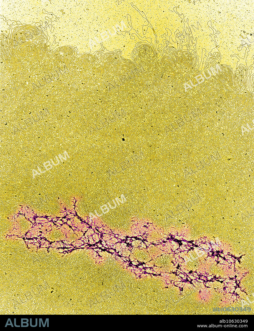 Colour enhanced TEM of isolated chromosomes treated to permit the DNA to uncoil, forming a broad halo around the core proteins. Detail of 9E7818 & 9C9763.