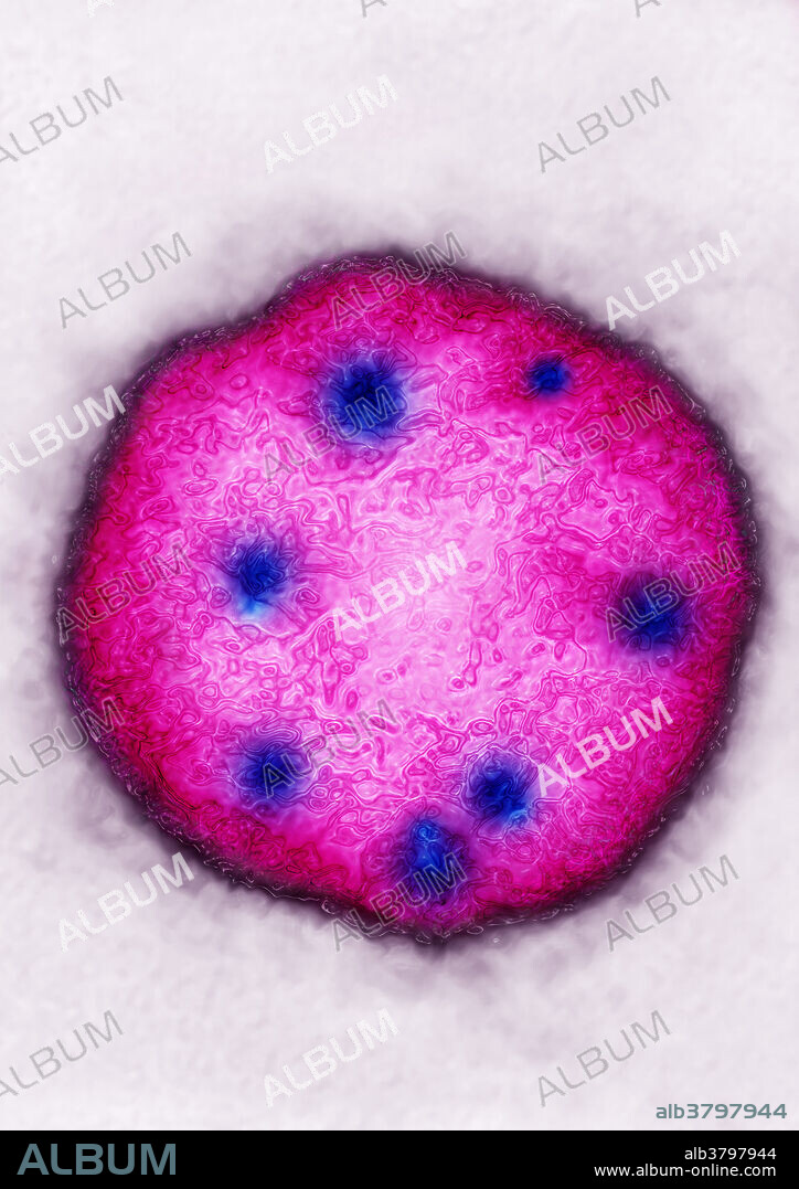 Arenavirus - Lassa virus - LASV. The arenavirus cause a acute haemorrhagic fever. It is endemic in West Africa and South America. Virus magnification: 83 000 X at 10 cm, and image colorization with HDRI treatments on a Transmission Electron Micrograph (TEM). Viral diameter approximately: 120 nm.