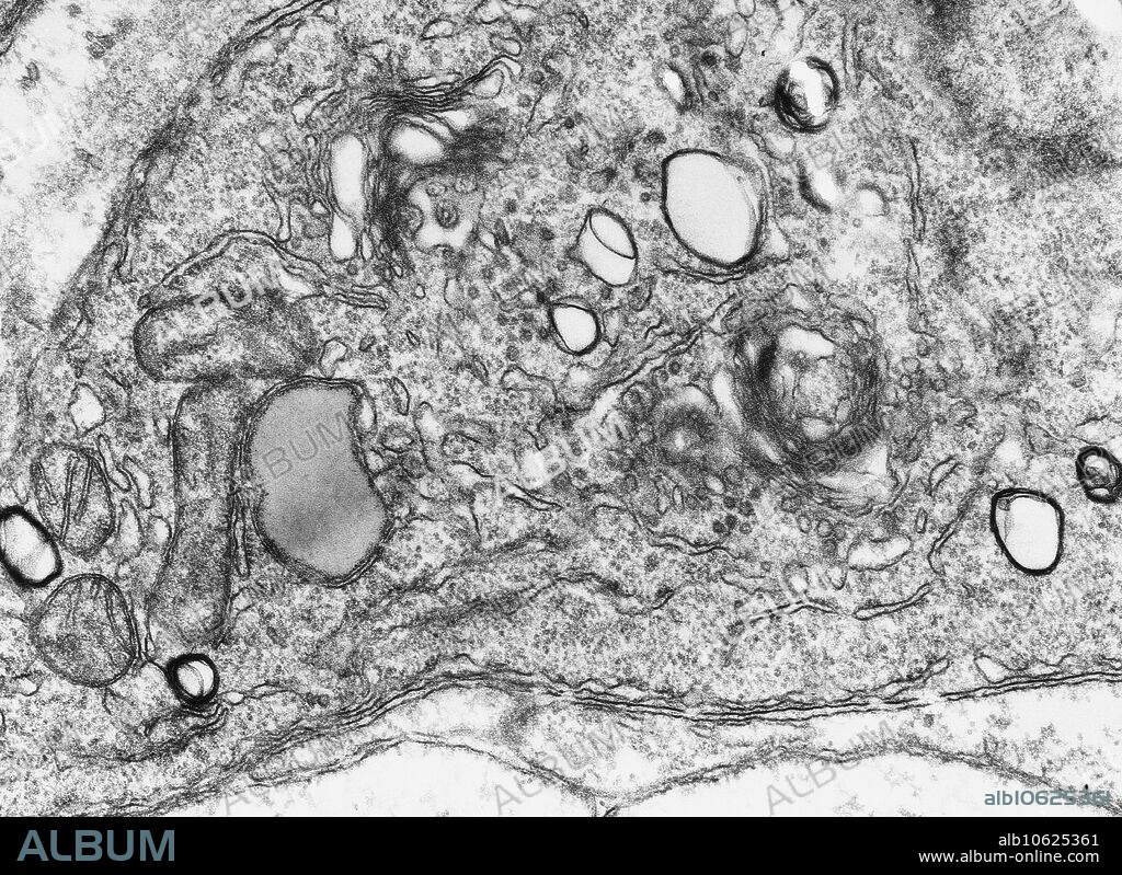 Animal cell. Transmission electron micrograph (TEM) of a section through the cytoplasm of a human cell showing cell orgaelles. Golgi bodies (stack of flattened membranes with dark outlines towards upper left) are membrane-bound organelles that modify and package proteins. At bottom left are two mitochondria (grey ovals), which produce the cell's energy.