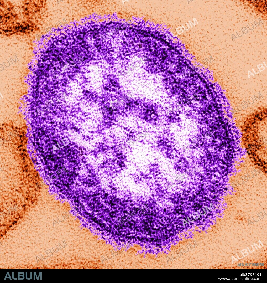 Transmission electron micrograph (TEM) revealed the ultrastructural appearance of a single virus particle, or "virion", of the measles virus. The measles virus is a paramyxovirus, of the genus Morbillivirus. It is 100-200 nm in diameter, with a core of single-stranded RNA, and is closely related to the Rinderpest and canine distemper viruses. Two membrane envelope proteins are important in pathogenesis. They are the F (fusion) protein, which is responsible for fusion of virus and host cell membranes, viral penetration, and hemolysis, and the H (hemagglutinin) protein, which is responsible for adsorption of virus to cells. There is only one antigenic type of measles virus. Although studies have documented changes in the H glycoprotein, these changes do not appear to be epidemiologically important (i.e., no change in vaccine efficacy has been observed).