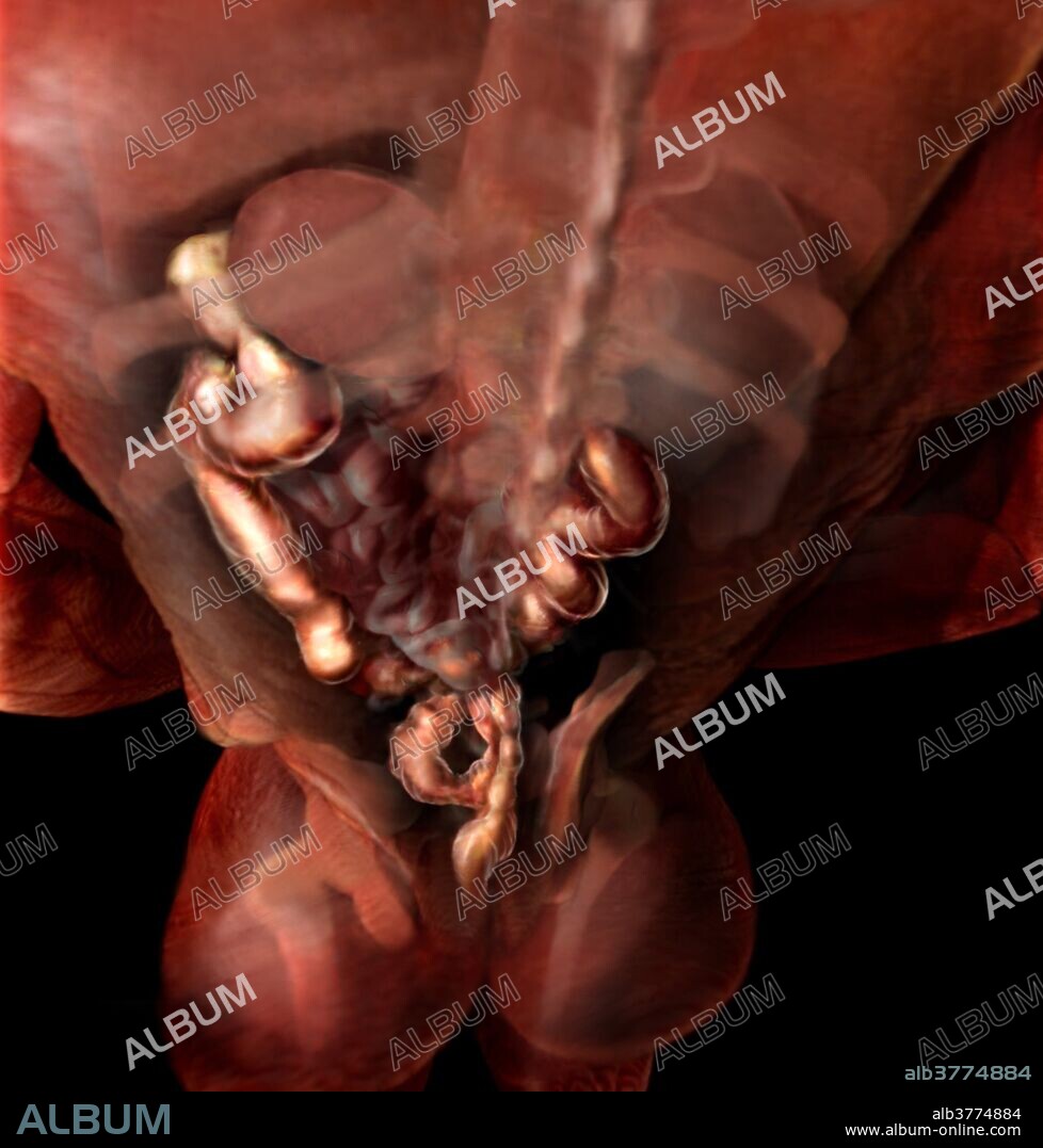 Medical visualization of the posterior view of a male torso and abdomen. The colon, kidneys, spinal colon and ribs are revealed.