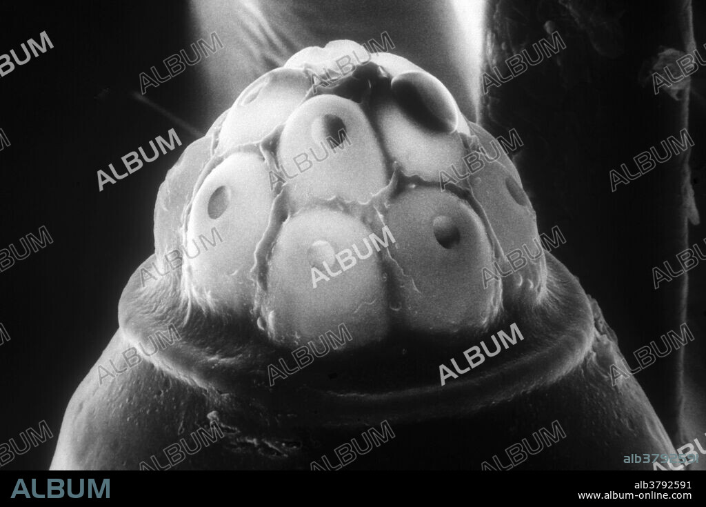 Scanning electron microscope (SEM) of a crab louse nit, showing operculum.