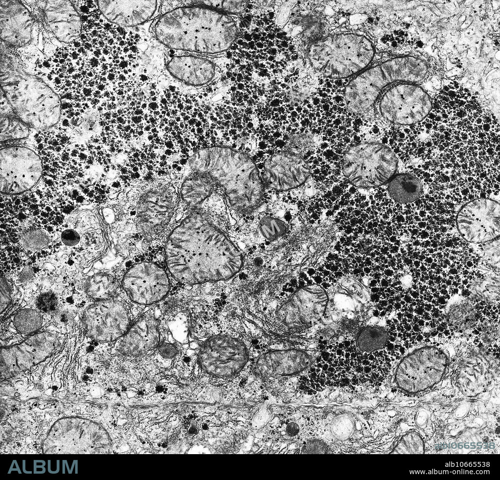 Glycogen in liver cells, transmission electron micrograph (TEM). Glycogen (dark granules) is the storage form of glucose. It is produced and stored in the liver cells (hepatocytes).