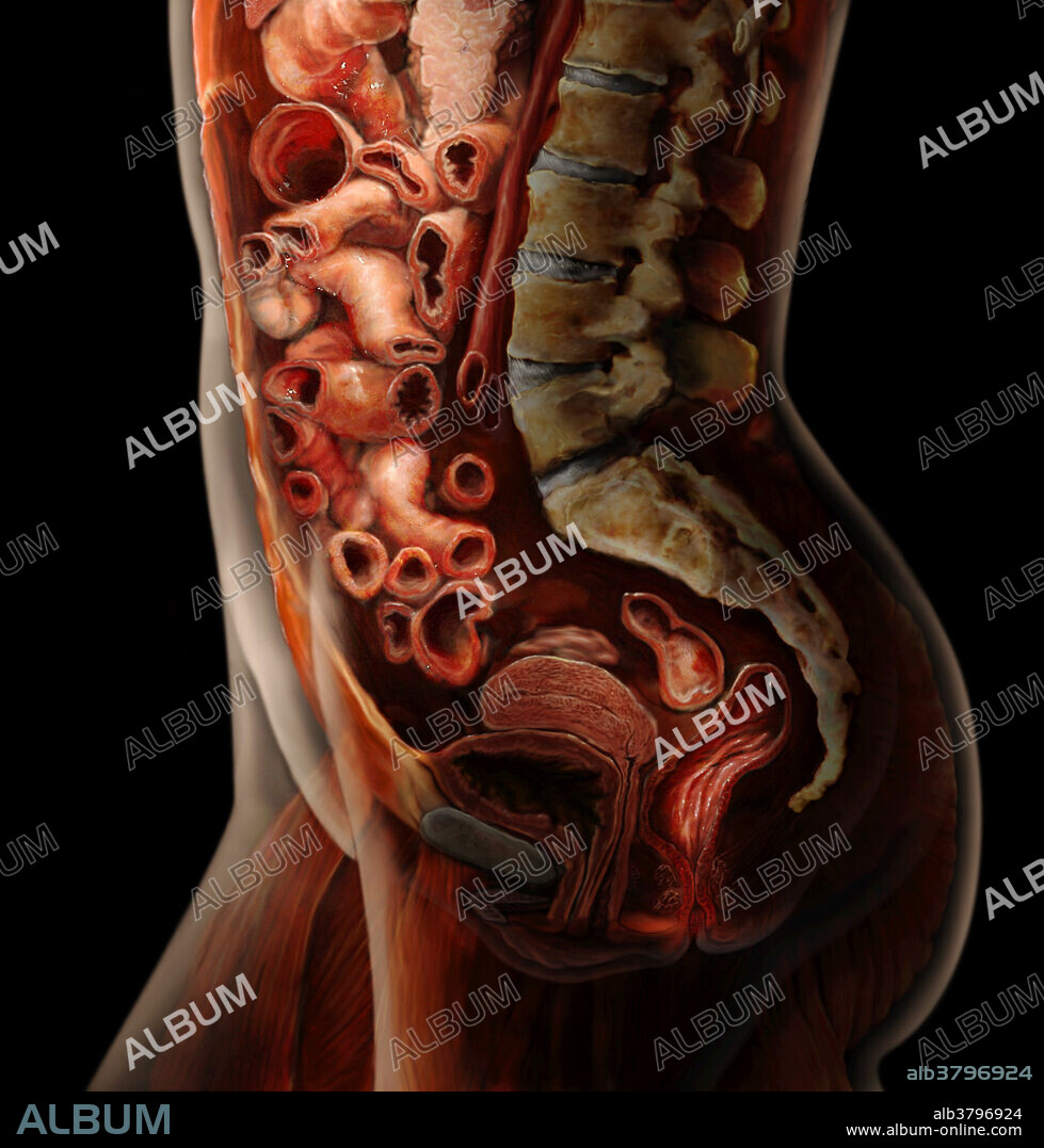 Lateral view of the female abdomen, highlighting portions of the lower digestive tract (small intestine, colon, rectum, and anus) and their relationship to the uterus, bladder, and sacrum. The digestive system is comprised of an alimentary canal and accessory organs; together they break down complex food into simple structures the body can use, absorb the nutrients into the blood stream, and eliminate waste.