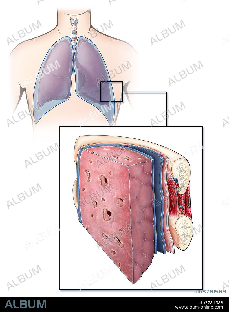 An illustrated section of a lung and the ribcage showcasing different layers of tissue and muscle. The pleura (blue) is a serous membrane covering the lungs (visceral pleura) and chest wall (parietal pleura), creating a fluid filled space (pleural cavity) which lubricates the lungs to aid in breathing. Between each rib are a series of intercostal muscles, arteries, veins and nerves. A layer of endothoracic fascia also lines the inner surface of the ribcage.
