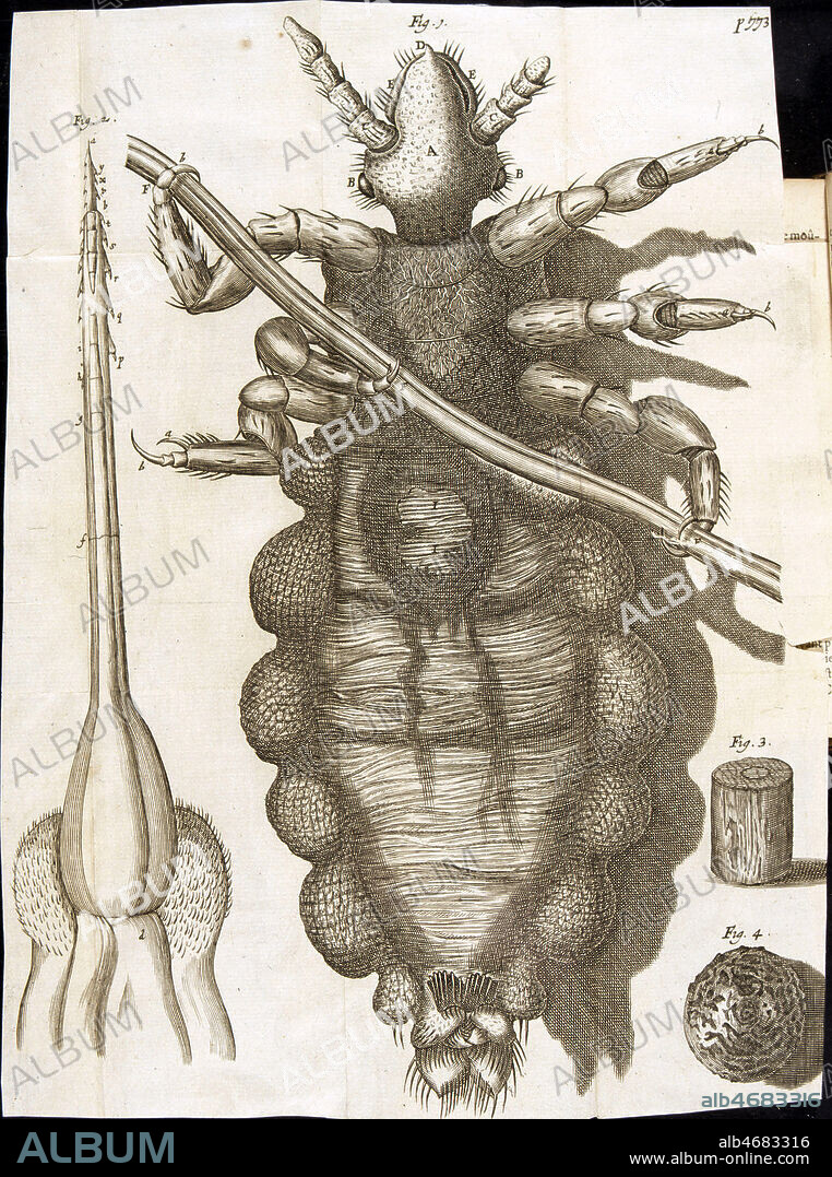 Un pou vu au microscope. Illustration tiree du 'Journal des savants', datant de 1665 par le Sieur de Herouville . (17e, 17eme, XVIIe s.) Credit : JEAN VIGNE / KHARBINE-TAPABOR.