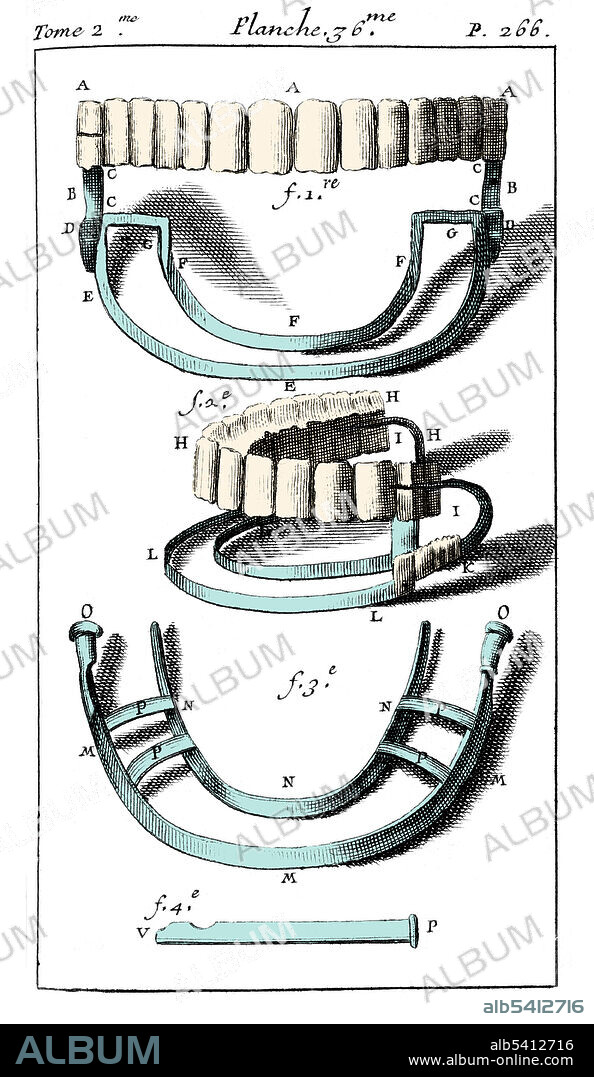 Artificial teeth with springs. Pierre Fauchard (1678 - 1761) was a French physician, credited as being the father of modern dentistry. He is widely known for writing the first complete scientific description of dentistry, Le Chirurgien Dentiste (The Surgeon Dentist), published in 1728. The book described basic oral anatomy and function, signs and symptoms of oral pathology, operative methods for removing decay and restoring teeth, periodontal disease, orthodontics, replacement of missing teeth, and tooth transplantation.