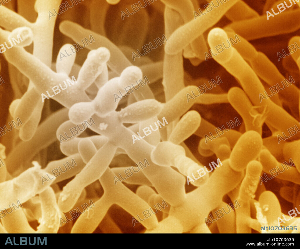 Trichophyton tonsurans, the fungus that is the causative agent of the skin condition tinea (or ringworm). Seen here are hyphae and microconidia (asexual spores). Ringworm (tinea) is a fungal skin infection which occurs on the scalp, body, male genitals (jock itch), feet (athlete's foot) and occasionally the nails. It produces typically round, scaly lesions or patches of hair loss, mainly in children. Use of antifungal drugs is effective as a treatment. SEM Magnification: 3090x.