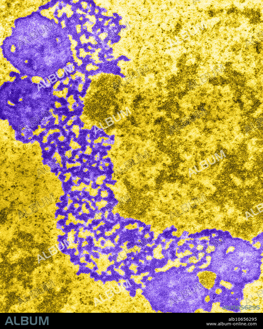Colour enhanced Transmission Electron Micrograph (TEM) showing nucleolema, the irregular network of fine ribonucleoprotein granules or microfilaments forming most of the nucleolus. The nucleolus is a non-membrane bound structure composed of proteins and nucleic acids found within the cell's nucleus. Magnification unknown.