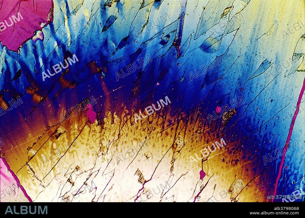 Polarized light micrograph (PLM) of zovirax, also known as acyclovir. Zovirax is an oral antiviral drug commonly used to treat genital herpes. Magnification: 10x.