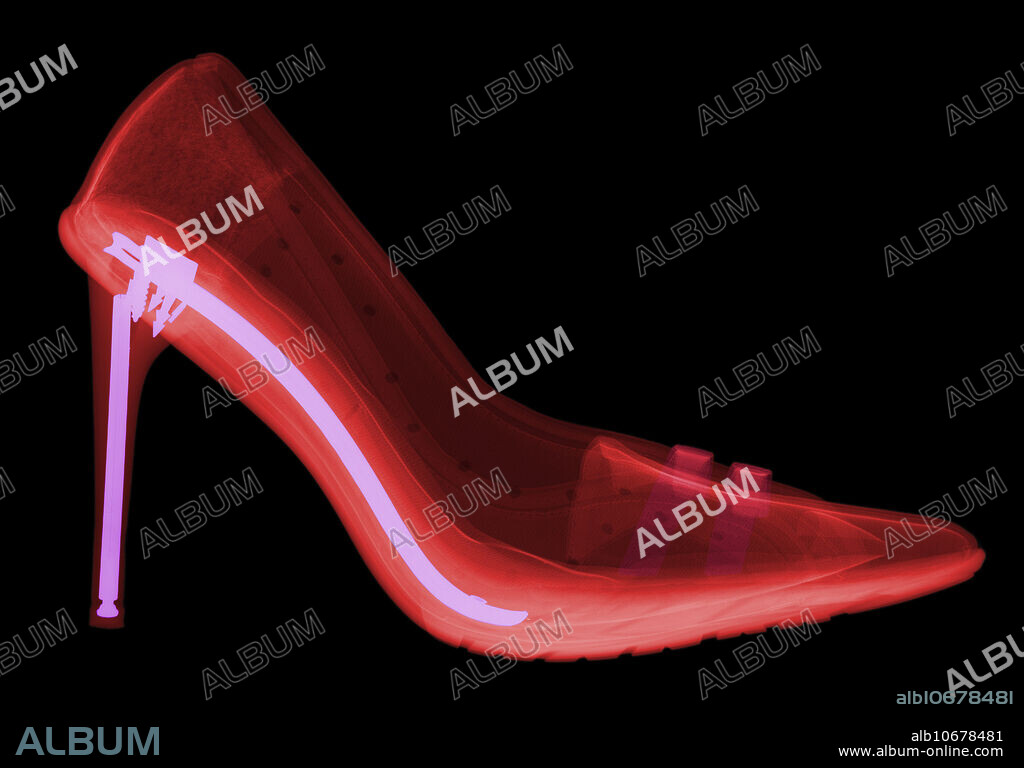 X-ray of a woman's high heel shoes.