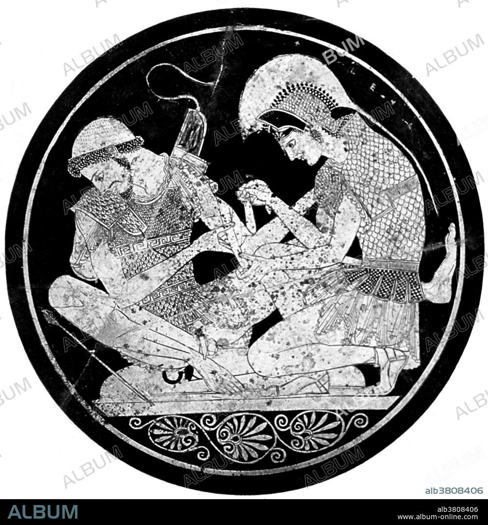 Achilles tending Patroclus' wounds from about 490-500 B.C. The painter is Euphronios, and the work is regarded as his masterpiece.  In Greek mythology, Achilles was a Greek hero of the Trojan War, the central character and the greatest warrior of Homer's Iliad. Legends state that Achilles was invulnerable in all of his body except for his heel. He died because of a small wound on his heel, thus the term Achilles' heel has come to mean a person's principal weakness. Patroclus was the son of Menoetius, grandson of Actor, King of Opus, and was Achilles' beloved comrade and brother-in-arms. The exact nature of Achilles' relationship with Patroclus has been a subject of dispute in both the classical period and modern times.