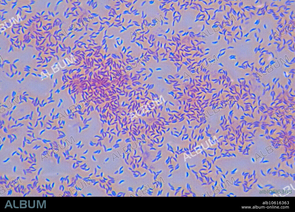 Light micrograph showing Vibrio cholerae, the bacteria that causes the disease Cholera; phase contrast illumination, magnification 400x at 35mm.