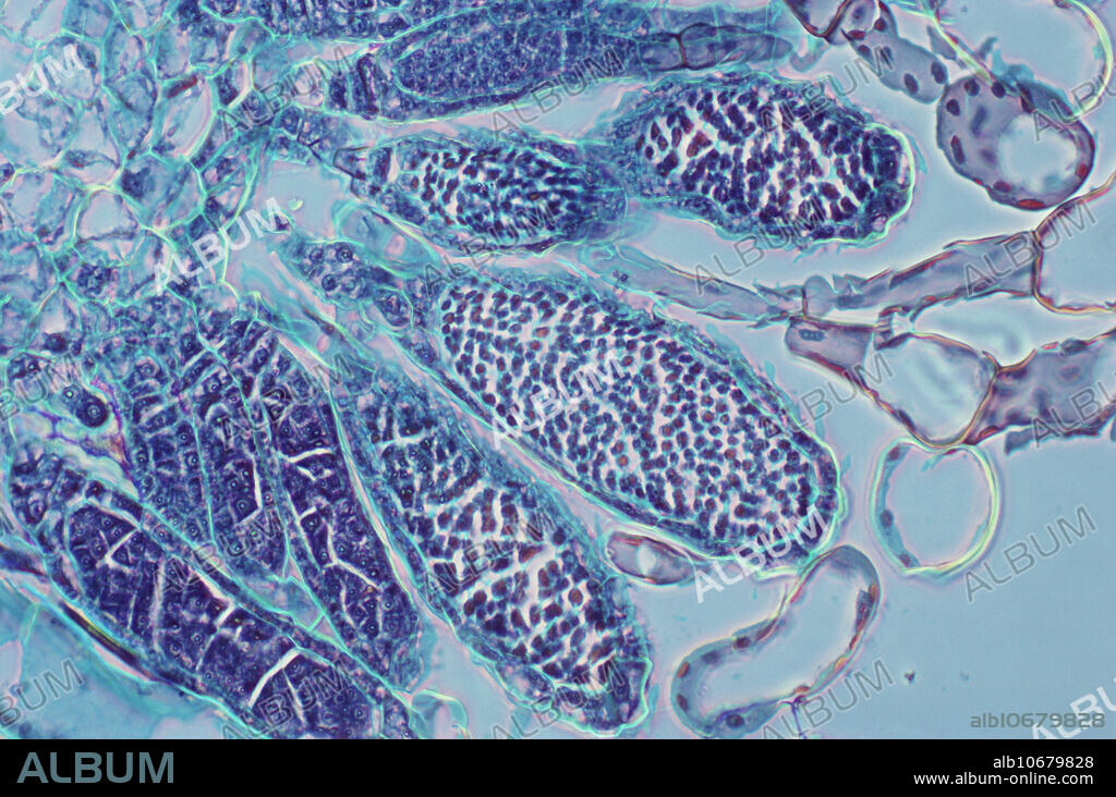 Light micrograph of antheridia from moss of the Funaria genus. Magnification x100 @ 35mm.