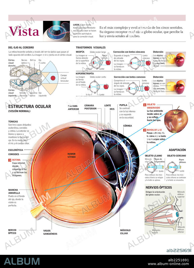 VISTA. Infografía del funcionamiento del ojo humano la formación de una imagen en el cerebro y de los trastornos visuales.