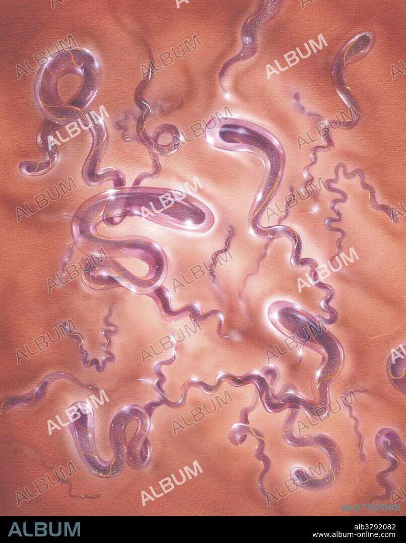 Illustration of Treponema Pallidum, a spirochette bacterium that causes syphilis, a sexually transmitted disease occurring in three stages that can be treated with antibiotics but not cured.