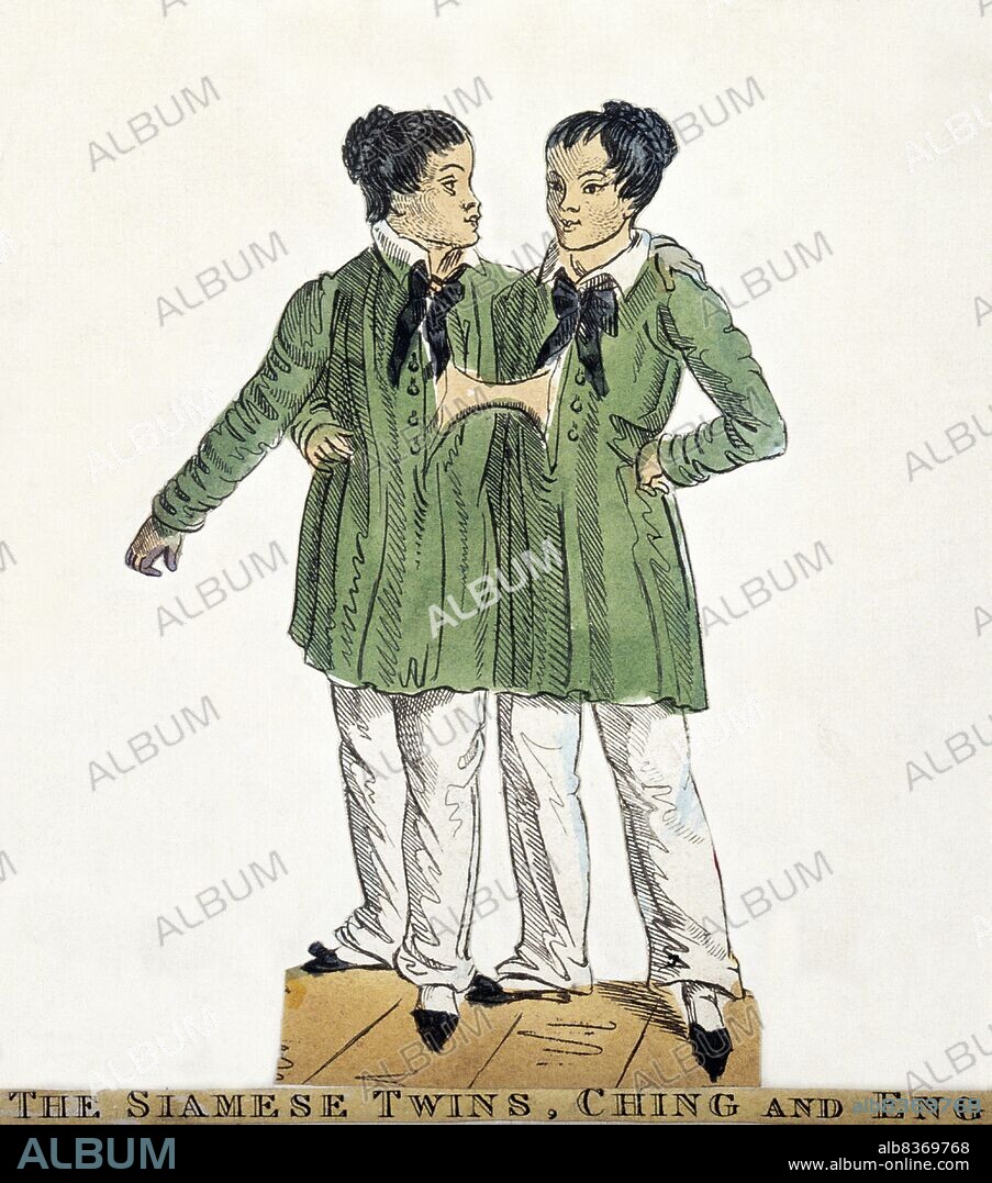 Chang and Eng Bunker (May 11, 1811 January 17, 1874) were Thai-American conjoined twin brothers whose condition and birthplace became the basis for the term 'Siamese twins'.<br/><br/>. The Bunker brothers were born on May 11, 1811, in the province of Samut Songkram, near Bangkok, in the Kingdom of Siam (today's Thailand). Their fisherman father was a Chinese Thai, while their mother was a Chinese Malaysian. Because of their Chinese heritage, they were known locally as the 'Chinese Twins'. The brothers were joined at the sternum by a small piece of cartilage, and though their livers were fused, they were independently complete.<br/><br/>. In 1829, Robert Hunter, a Scottish merchant who lived in Bangkok, saw the twins swimming and realized their potential. He paid their parents to permit him to exhibit their sons as a curiosity on a world tour. When their contract with Hunter was over, Chang and Eng went into business for themselves. In 1839, while visiting Wilkesboro, North Carolina, the brothers were attracted to the area and purchased a 110-acre (0.45 km2) farm in nearby Traphill.<br/><br/>. Determined to live as normal a life they could, Chang and Eng settled on their small plantation and bought slaves to do the work they could not do themselves. Using their adopted name 'Bunker', they married local women on April 13, 1843. Chang wed Adelaide Yates, while Eng married her sister, Sarah Anne. Chang and Adelaide would become the parents of eleven children. Eng and Sarah had ten. The twins also became naturalized American citizens.<br/><br/>. On January 17, 1874, Chang died while the brothers were asleep. Eng awoke to find his brother dead and cried, 'Then I am going'. A doctor was summoned to perform an emergency separation, but he was too late. Eng died approximately three hours later.