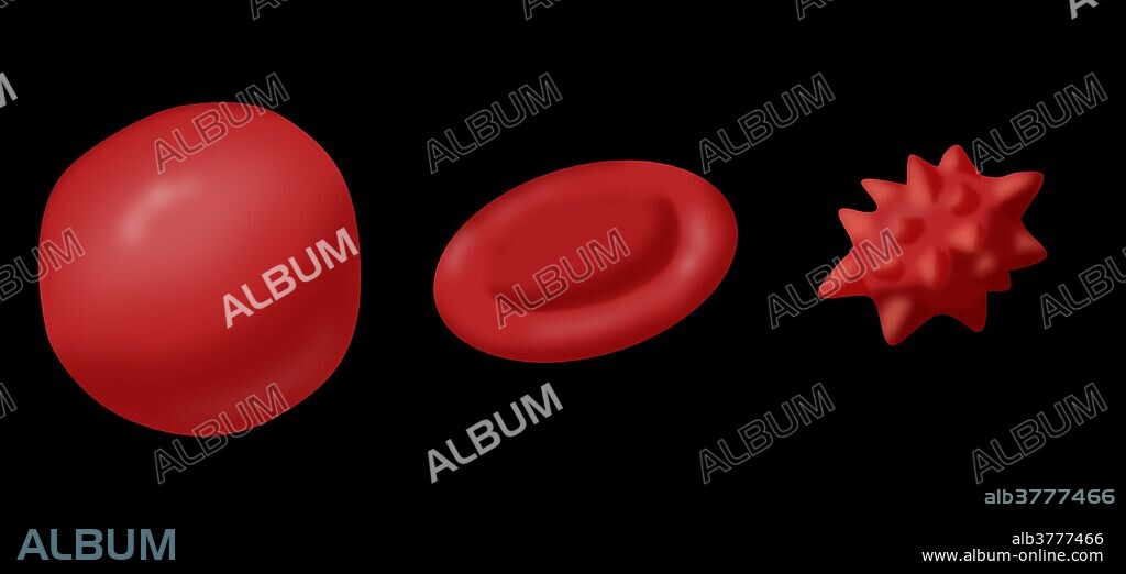 Illustration showing the effect of hypotonic, isotonic and hypertonic solutions on red blood cells.