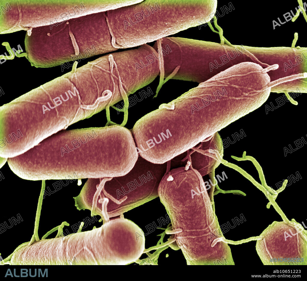 Colour enhanced scanning electron micrograph (SEM) of Bacillus subtilis. Bacillus subtilis, also known as grass bacillus or hay bacillus, is a Gram-positive, catalase-positive and rod-shaped bacterium. It is found in soil and the gastrointestinal tract of ruminants and humans. As with other members of the genus Bacillus, it can form an endospore, to survive extreme environmental conditions of temperature and desiccation. It is one of the bacterial champions in secreted enzyme production and used on an industrial scale by biotechnology companies. It is sometimes pathogenic in humans, causing severe eye infections such as anterior uveitis (inflammation of the middle layer of the eye), or iridocyclitis (inflammation of the iris). Magnification 30,000x when printed 15cm.