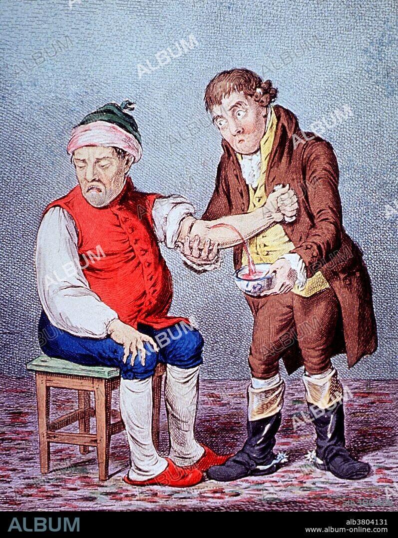 Bloodletting, 1804