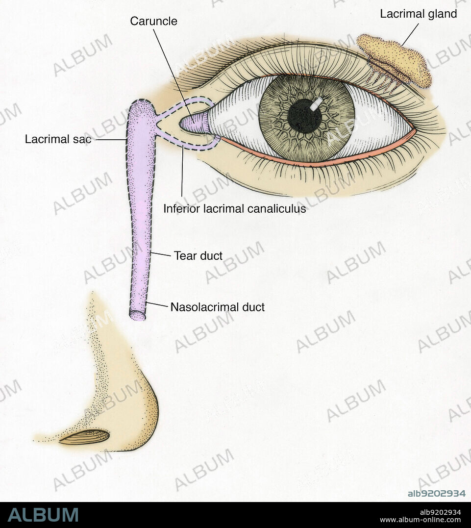 Anatomical illustration of tear duct, showing caruncle, lacrimal gland, lacrimal sac, inferior lacrimal canaliculus, and nasolacrimal duct.