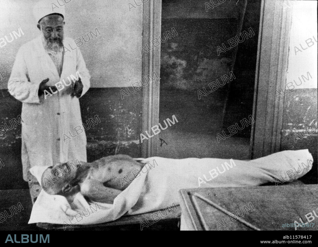 "Oldest Man" Dead.The body of Zaro Aga, who claimed to be the oldest man in the world, and said he was 160 years ***** old. He died at Istanbul, Turkey, on June 29th. August 12, 1934. (Photo by Sport & General Press Agency Limited).
