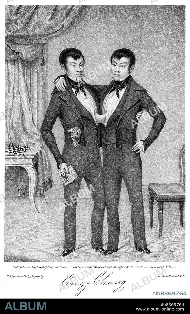 Chang and Eng Bunker (May 11, 1811 January 17, 1874) were Thai-American conjoined twin brothers whose condition and birthplace became the basis for the term 'Siamese twins'.<br/><br/>. The Bunker brothers were born on May 11, 1811, in the province of Samut Songkram, near Bangkok, in the Kingdom of Siam (today's Thailand). Their fisherman father was a Chinese Thai, while their mother was a Chinese Malaysian. Because of their Chinese heritage, they were known locally as the 'Chinese Twins'. The brothers were joined at the sternum by a small piece of cartilage, and though their livers were fused, they were independently complete.<br/><br/>. In 1829, Robert Hunter, a Scottish merchant who lived in Bangkok, saw the twins swimming and realized their potential. He paid their parents to permit him to exhibit their sons as a curiosity on a world tour. When their contract with Hunter was over, Chang and Eng went into business for themselves. In 1839, while visiting Wilkesboro, North Carolina, the brothers were attracted to the area and purchased a 110-acre (0.45 km2) farm in nearby Traphill.<br/><br/>. Determined to live as normal a life they could, Chang and Eng settled on their small plantation and bought slaves to do the work they could not do themselves. Using their adopted name 'Bunker', they married local women on April 13, 1843. Chang wed Adelaide Yates, while Eng married her sister, Sarah Anne. Chang and Adelaide would become the parents of eleven children. Eng and Sarah had ten. The twins also became naturalized American citizens.<br/><br/>. On January 17, 1874, Chang died while the brothers were asleep. Eng awoke to find his brother dead and cried, 'Then I am going'. A doctor was summoned to perform an emergency separation, but he was too late. Eng died approximately three hours later.