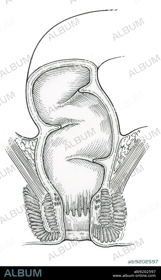 Anatomical illustration of rectum in frontal section, showing anus, anal canal, sphincter muscle, anal columns, levator ani muscle, internal rectum, and transverse fold.
