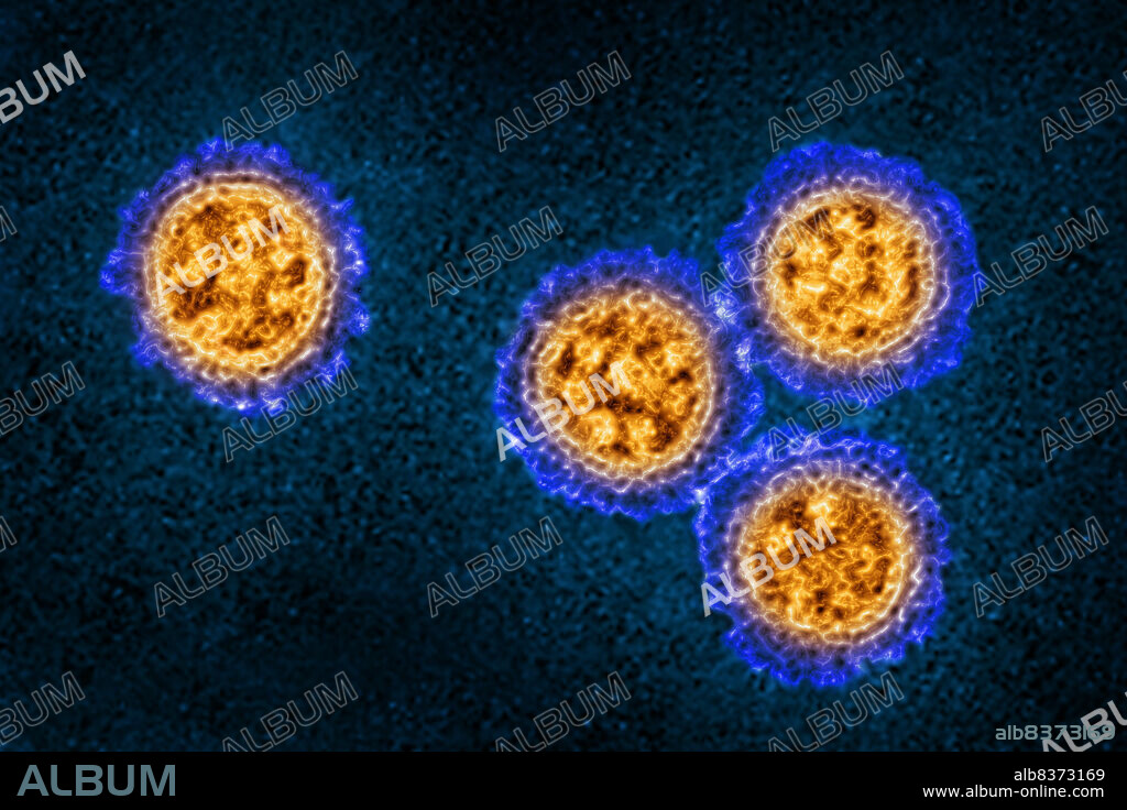 Influenza virus (from the Orthomyxoviridae family and the Influenzavirus genus). Image made from a transmission electron microscopy view.