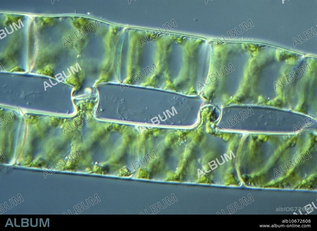 Light micrograph showing conjugating filaments of Spirogyra sp., a green alga which forms slimy threads in stagnant or slow moving water. Conjugation, a form of sexual reproduction, occurs in spring when the threads come together in pairs. Both filaments put out papillae which meet to form conjugation tubes (seen here). Cytoplasmic mass from the cells of one of the threads (termed male) migrates through the tubes to fuse with the cytoplasm in the (female) cells of the second thread. This produces a zygospore which either germinates at once or lies dormant until the following spring. Magnification: x150 at 35mm size.