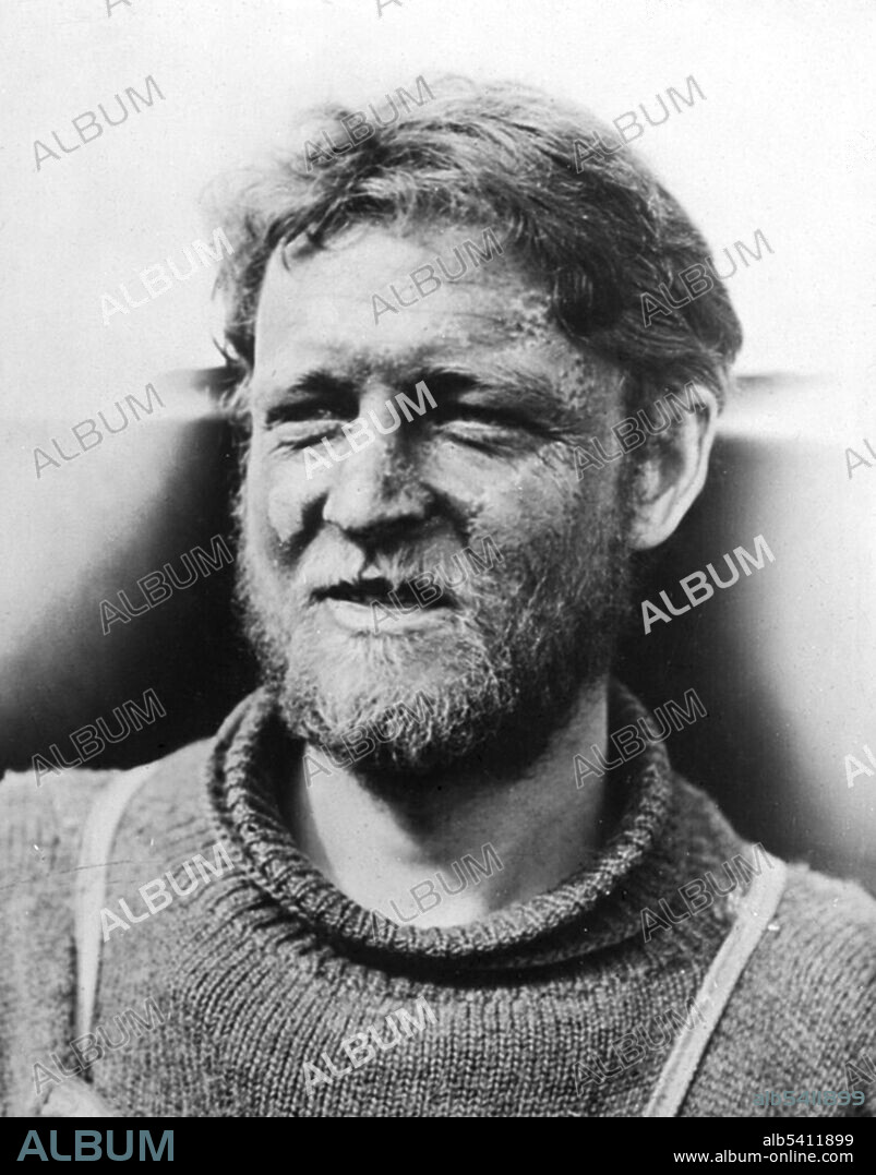 The frostbitten face of team meteorologist Cecil Thomas Madigan, a member of the Australasian Antarctic Expedition of 1911-1914. Photograph taken by Frank Hurley (1885-1962), c 1913.
