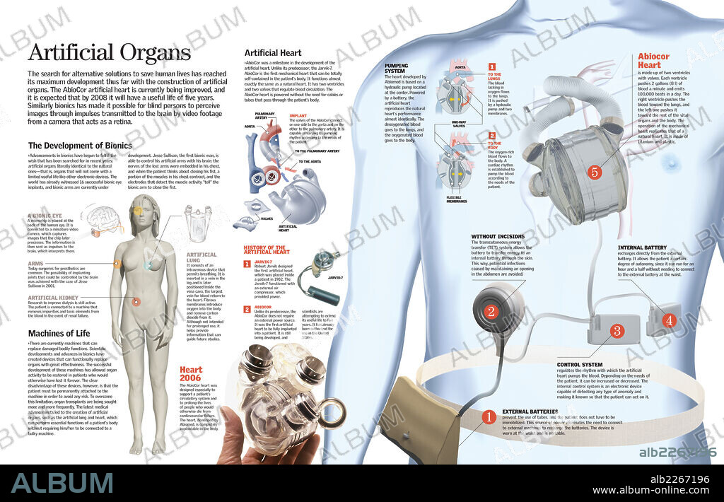 órganos artificiales. Infografía de los principales órganos artificiales que se utilizan para reemplazar órganos dañados del organismo: el corazón artificial y los implantes biónicos.