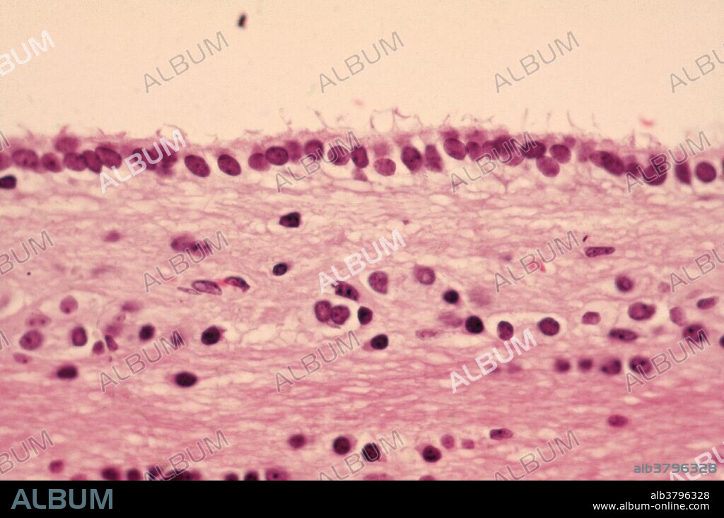 Ependymal cells; Simple cuboidal epithelium lining of the brain ventricles and spinal cord.