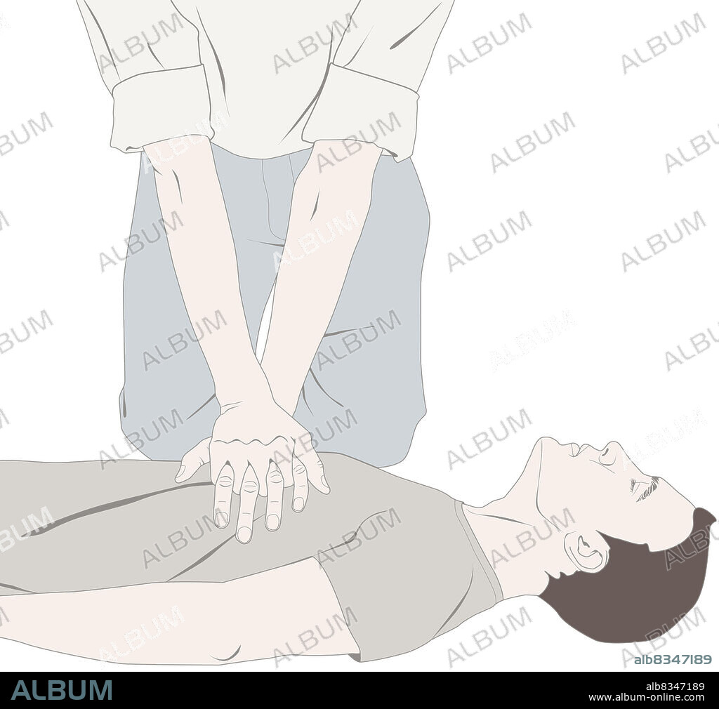 Keeping your elbows locked and arms straight, compress the victim's chest approximately 2 inches (5 cm), then reduce the pressure, at the rate of 15 compressions every 10 seconds. You can, to help you, count each compression out loud, as follows: 1 and 2 and 3 and 4 and 5 and 1 and 2 and 3 and 4 and 10 and 1 and 2 and 3 and 4 and 15. After 30 compressions, give 2 rescue breaths, all of which is equivalent to one CPR cycle.