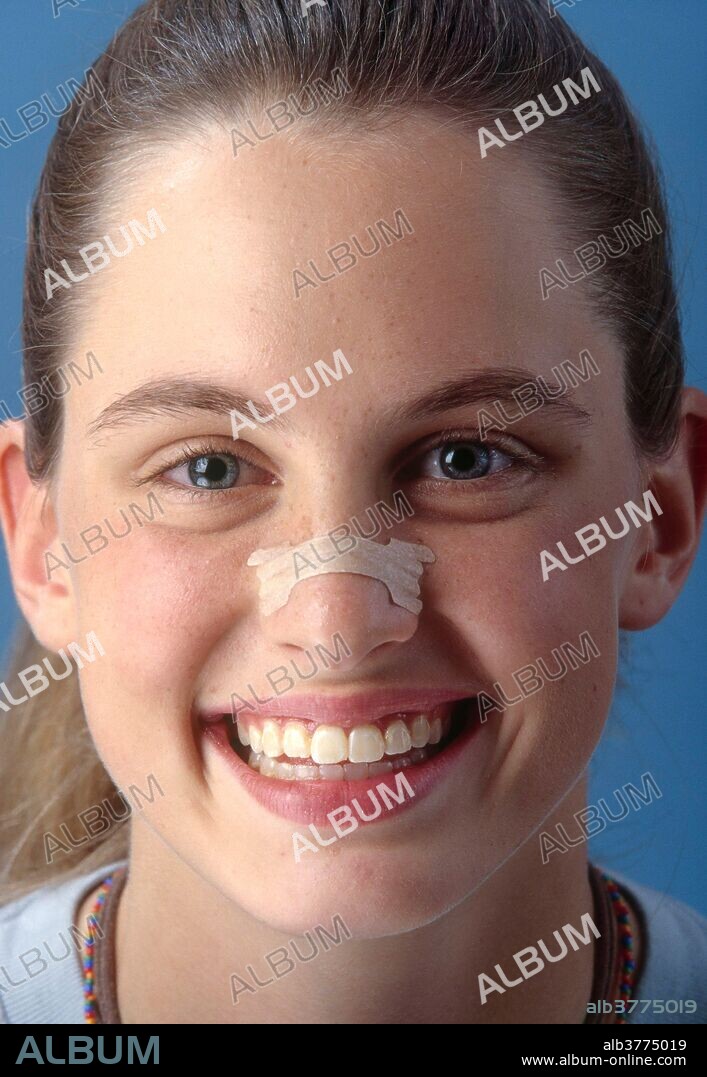 A teenager wearing a nasal strip, intended to provide relief from rhinitis, hay fever and symptoms of the common cold by allowing a clear passage of air through the nostrils.