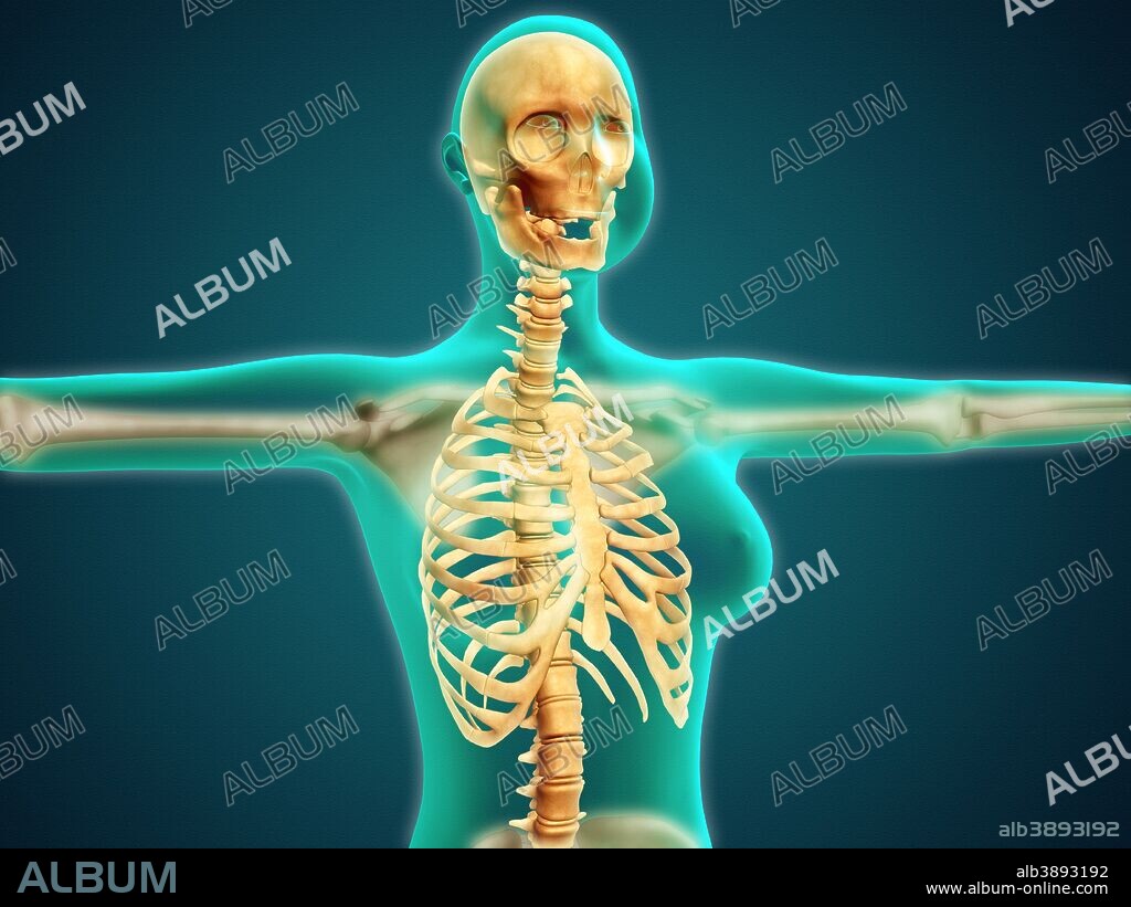 X-ray view of female upper body showing rib cage, spine and skull.