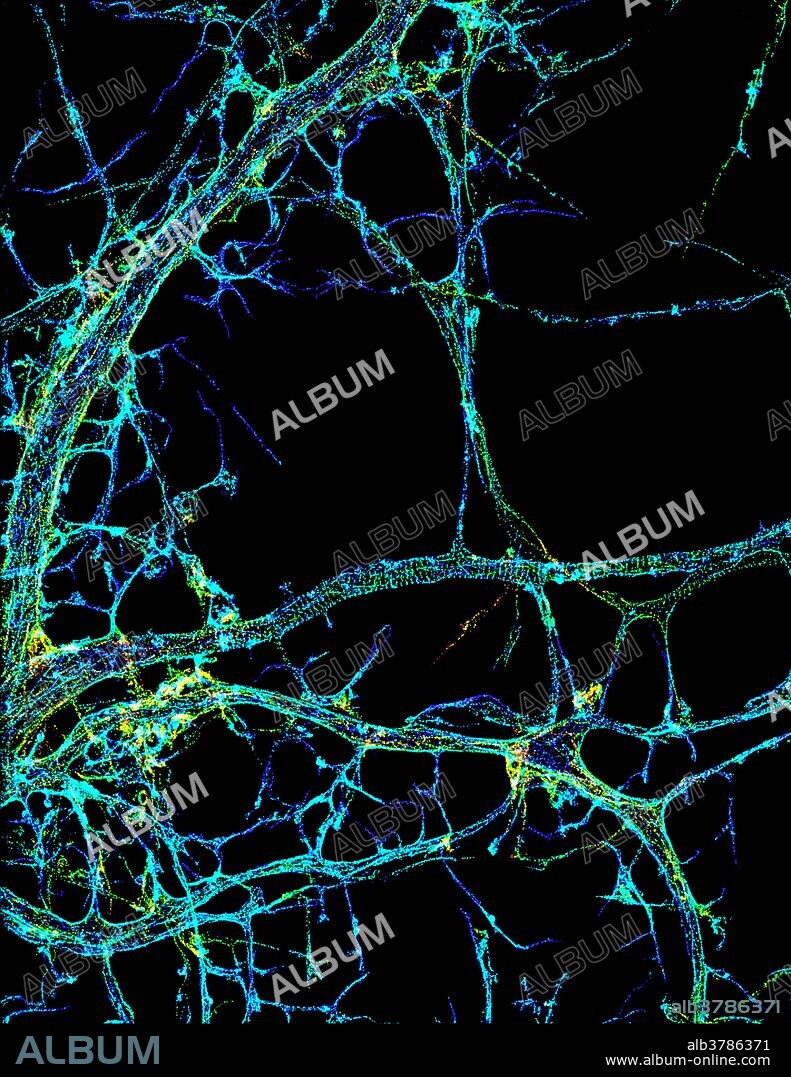 Image shows the long, branched structures (axons) of nerve cells. Running horizontally across the middle of the photo is an axon wrapped in rings made of actin protein (green), which plays important roles in nerve cells. The image was captured with a powerful microscopy technique that allows scientists to see single molecules in living cells in real time. The technique is called stochastic optical reconstruction microscopy (STORM). It is based on technology so revolutionary that its developers earned the 2014 Nobel Prize in Chemistry.