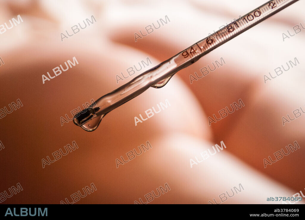 Lubricated rectal thermometer about to be inserted into the rectum of a waiting patient. Glass mercury thermometers as well as the rectal method have largely fallen out of favour due to safety and environmental concerns.