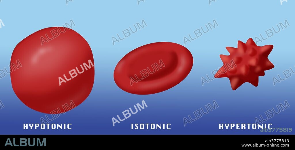 Illustration showing the effect of hypotonic, isotonic and hypertonic solutions on red blood cells.