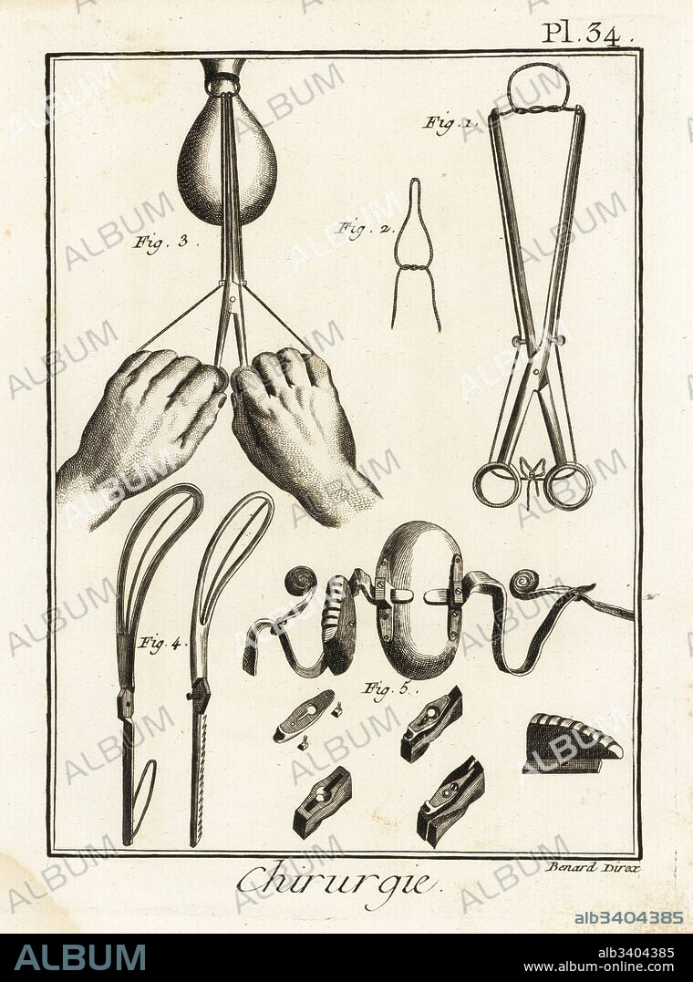 Wire-knot tweezers for obstetrics 1,2, use of the wire-knot tweezer to remove an uterine polyp 3, tweezers and speculum invented by Andre Levret 4,5. Copperplate engraving by Robert Benard from Denis Diderot's Encyclopedia, Pellet, Geneva, 1779.