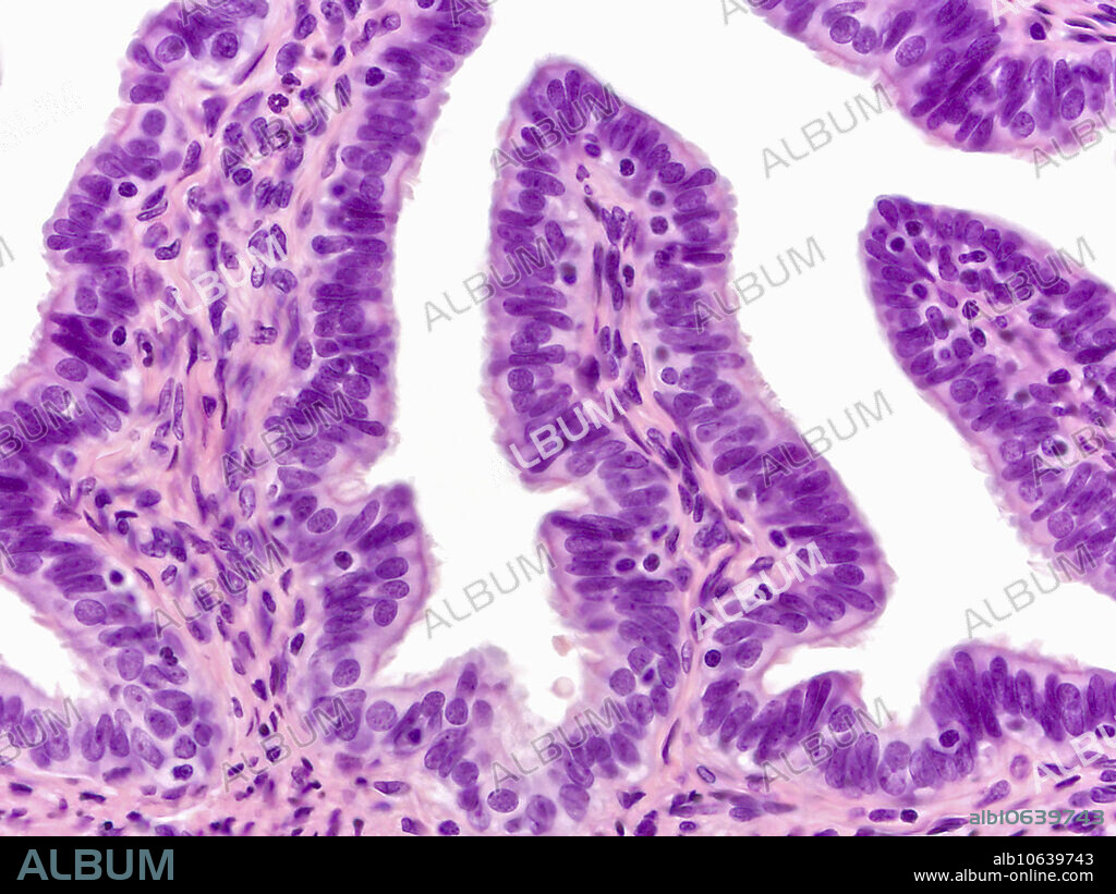 Reproductive system; female; Fallopian tube; oviduct, uterine tube; ampulla; human. Light micrograph. Magnification = 320x. HE Stain.