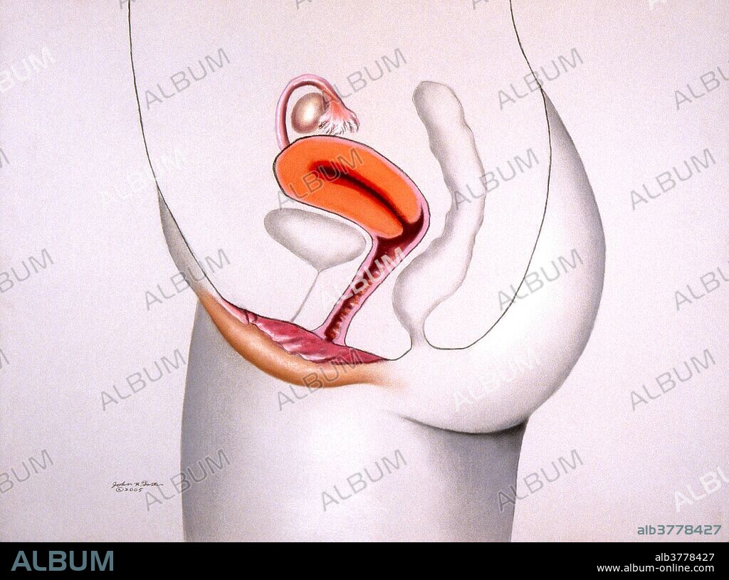 In this view the female reproductive organs are shown in color. From the top working down, are the ovary, fallopian tube, uterus, vagina, clitoris, labia minora, and labia majora. The last three make up the vulva or female genitals.