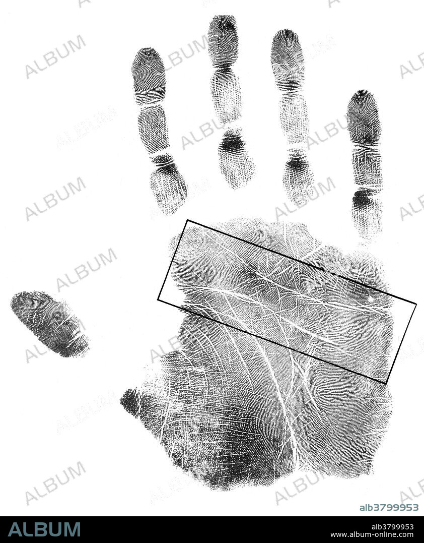 Entitled: "The lines of the head and heart. The chain about one-third the way down the length of the Head line indicates a particularly difficult period of Head activity." Palmistry is the claim of characterization and foretelling the future through the study of the palm. The practice is found all over the world, with numerous cultural variations. Those who practice chiromancy are called palmists, palm readers, hand readers, hand analysts, or chirologists. There are many, often conflicting, interpretations of various lines and palmar features across various schools of palmistry. These contradictions between different interpretations, as well as the lack of empirical support for palmistry's predictions, contribute to palmistry's perception as a pseudoscience.The head line reveals mental and psychological makeup and the intellectual development and intuitive capabilities. The heart line give an indication about a person's emotional state and their emotional and physical relationships with others.No photographer credited, undated.