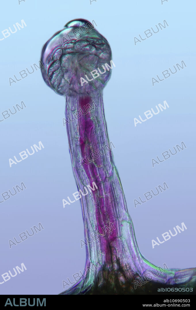 Cannabis plant. Polarised Light Microscope of the surface of a cannabis (Cannabis sativa) plant. Glandular cells called trichomes are present. These are capitate trichomes that have stalks. These trichomes secrete a resin containing tetrahydrocannabinol (THC), the active component of cannabis when used as a drug. The field of view of this image is 5 mm.