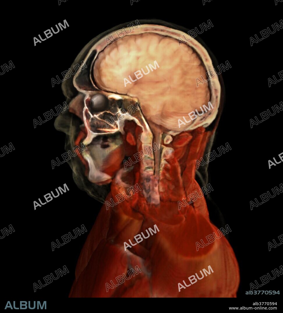 3D visualization reconstructed from scanned human data of mid-sagittal cut of the the head featuring the nasal cavity.