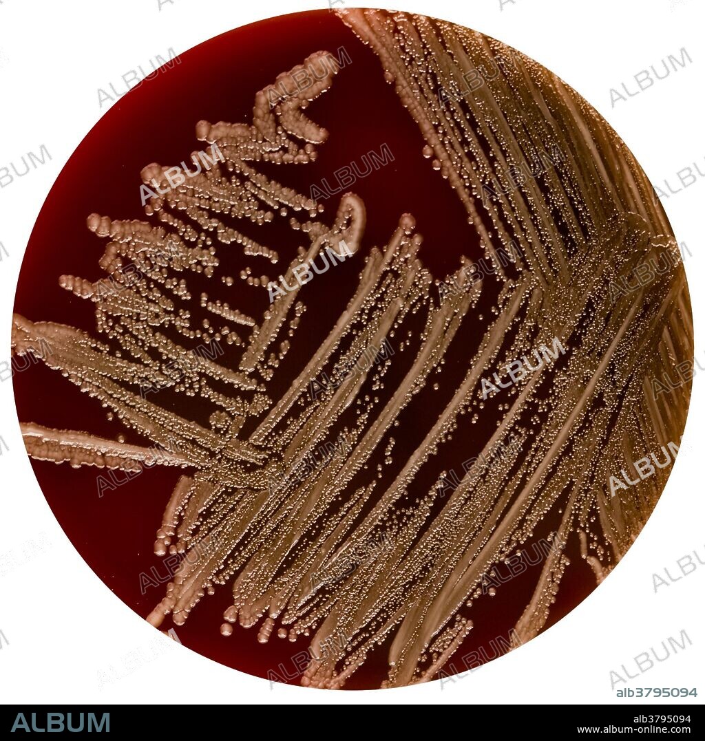 Yersinia pestis (formerly Pasteurella pestis) is a Gram-negative rod-shaped bacterium belonging to the family Enterobacteriaceae. It is a facultative anaerobe that can infect humans and other animals. Human Y. pestis infection takes three main forms: pneumonic, septicemic, and the notorious bubonic plagues. All three forms have been responsible for high mortality rates in epidemics throughout human history, including the Black Death (a bubonic plague) that accounted for the death of at least one-third of the European population in 1347 to 1353.