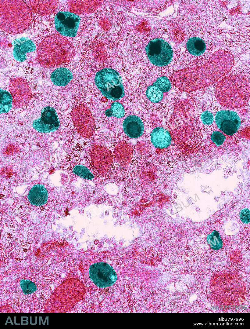 Colour enhanced transmission electron micrograph showing lysosomes (blue-green) in a liver cell. No magnification given. Lysosomes are cellular organelles that contain acid hydrolase enzymes to break down waste materials and cellular debris. The name lysosome derives from the Greek words lysis, to separate, and soma, body. They are frequently nicknamed suicide-bags or suicide-sacs by cell biologists due to their role in autolysis, more commonly known as self-digestion, refers to the destruction of a cell through the action of its own enzymes.