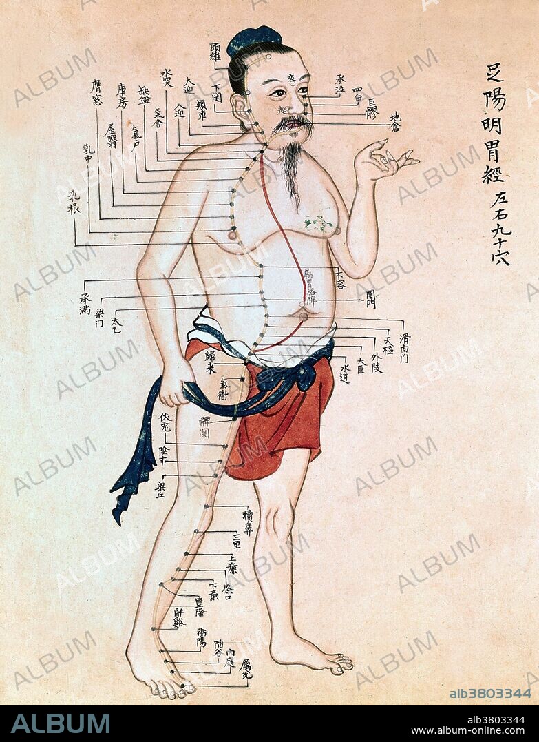 Male figure, wearing blue and red loin-cloth, marked with acupuncture points, undated. Acupuncture, along with moxibustion, is one of the oldest practices of Traditional Chinese Medicine. Most historians believe the practice began in China, though there are some conflicting narratives on when it originated. The first documentation of an "organized system of diagnosis and treatment" for acupuncture was in The Yellow Emperor's Classic of Internal Medicine (Huangdi Neijing) from about 100 BC. Gold and silver needles found in the tomb of Liu Sheng from around 100 BC are believed to be the earliest archeological evidence of acupuncture, though it is unclear if that was their purpose. Acupuncture is a form of alternative medicine involving thin needles inserted into the body at acupuncture points (several hundred acupuncture points are claimed to be located along what practitioners call meridians).